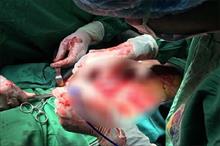 Bác sĩ dùng tay xoa bóp trực tiếp quả tim, cứu nữ bệnh nhân bị đâm